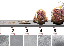 Biofilm