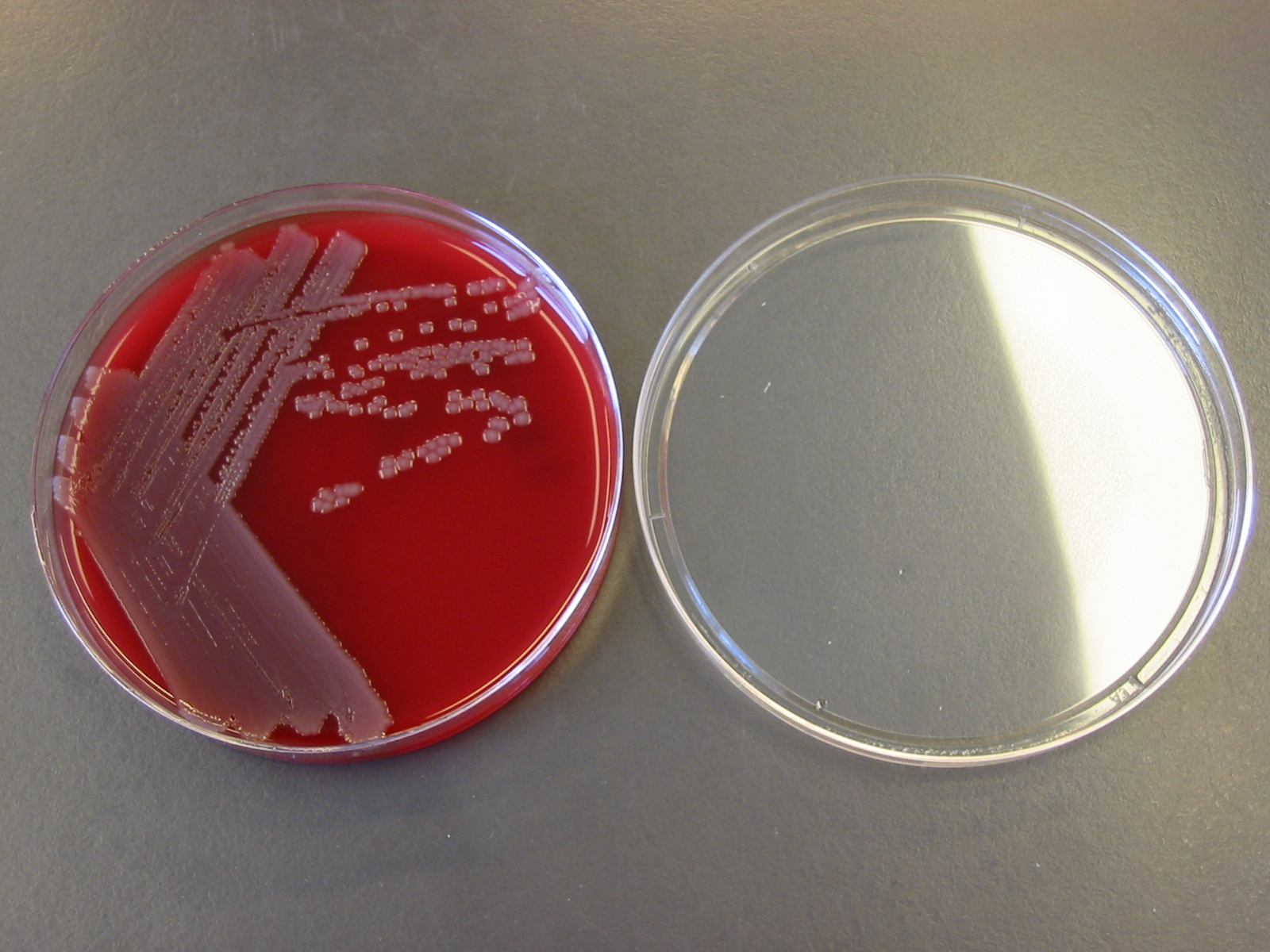 Voedingsmedium Ecoli